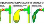 УЗИ желчного пузыря — простое и с определение функции, как подготовиться