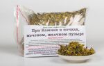 Лечение камней в желчном пузыре