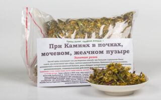 Лечение камней в желчном пузыре