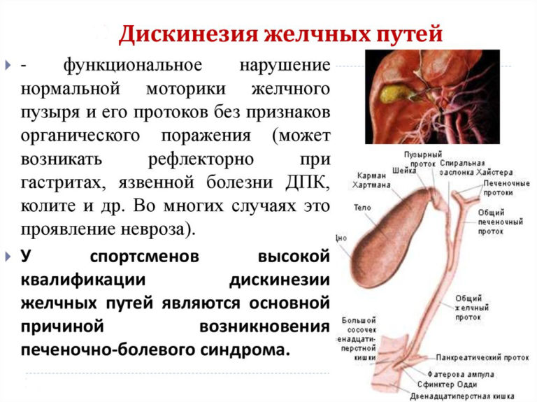 Хронический Холецистит Холангит Диета.